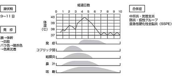 麻疹