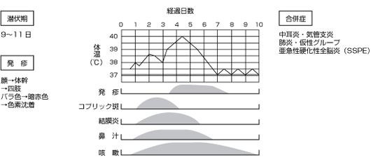 麻疹