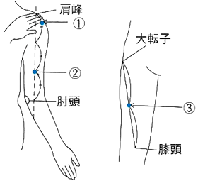 皮下注射の注射部位