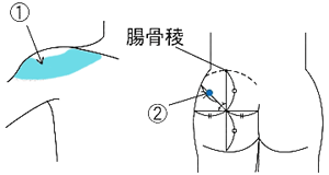 筋肉内注射の注射部位