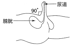 導尿の体位（男性）