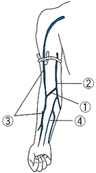 静脈内注射の注射部位