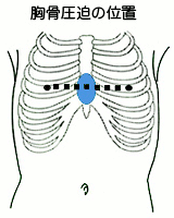 胸骨圧迫の位置