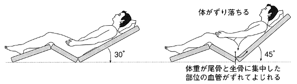 褥瘡予防の体位