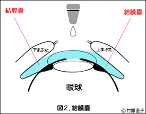 結膜嚢