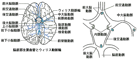 脳底部腫瘍血管とウィリス動脈輪